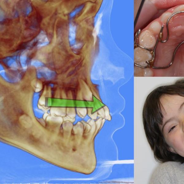 Airway, Apnea, Orthodontics, and OPT Online Course